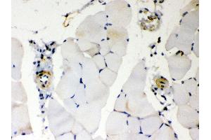 Anti- BAK Picoband antibody, IHC(P) IHC(P): Mouse Skeletal Muscle Tissue (BAK1 Antikörper  (AA 22-211))