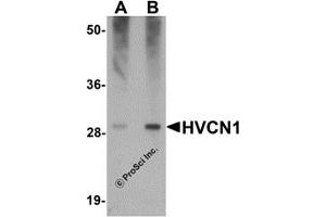 Western Blotting (WB) image for anti-Hydrogen Voltage-Gated Channel 1 (HVCN1) (C-Term) antibody (ABIN1030426) (HVCN1 Antikörper  (C-Term))