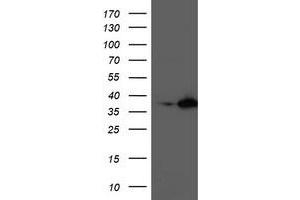Western Blotting (WB) image for anti-Nudix (Nucleoside Diphosphate Linked Moiety X)-Type Motif 18 (NUDT18) antibody (ABIN1499860) (NUDT18 Antikörper)