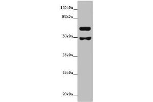 Western blot All lanes: GALNT16 antibody at 12 μg/mL + Mouse kidney tissue Secondary Goat polyclonal to rabbit at 1/10000 dilution Predicted band size: 64, 61 kDa Observed band size: 64, 49 kDa (WBSCR17 Antikörper  (AA 301-558))