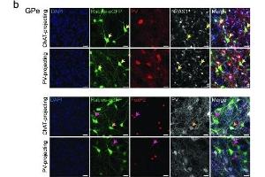 Immunofluorescence (Paraffin-embedded Sections) (IF (p)) image for anti-Neuronal PAS Domain Protein 1 (NPAS1) antibody (ABIN2856208)