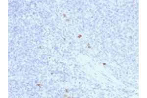 Formalin-fixed, paraffin-embedded human Tonsil stained with IgG4 Mouse Recombinant Monoclonal Antibody (rIGHG4/1345). (Rekombinanter IGHG4 Antikörper)