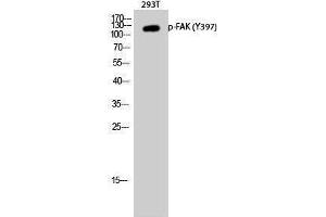 Western Blotting (WB) image for anti-PTK2 Protein tyrosine Kinase 2 (PTK2) (pTyr397) antibody (ABIN3182621) (FAK Antikörper  (pTyr397))