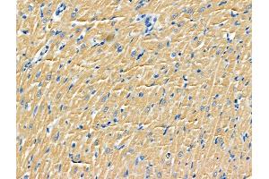 ABIN6264860 and ABIN6266755 at 1/100 staining Rat heart tissue by IHC-P. (RPS9 Antikörper  (Internal Region))