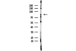 anti-Heterogeneous Nuclear Ribonucleoprotein R (HNRNPR) (C-Term) antibody