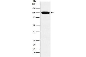 Western blot analysis of VPS18 expression in K562 cell lysate.
