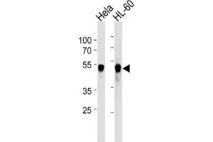 Western Blotting (WB) image for anti-Vaccinia Related Kinase 1 (VRK1) antibody (ABIN2905796) (VRK1 Antikörper)
