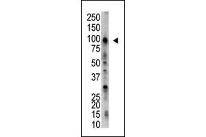 Image no. 1 for anti-Ubiquitin Specific Peptidase 5 (USP5) (C-Term) antibody (ABIN357529) (USP5 Antikörper  (C-Term))