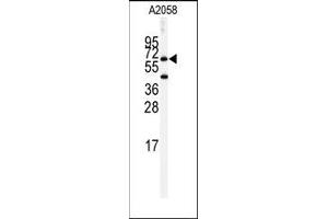 Image no. 1 for anti-Butyrylcholinesterase (BCHE) (Middle Region) antibody (ABIN360174) (Butyrylcholinesterase Antikörper  (Middle Region))