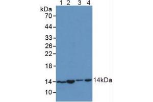 Figure. (SNRPD1 Antikörper  (AA 1-119))