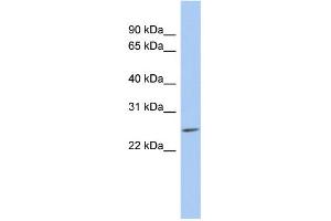 WB Suggested Anti-LYPD5 Antibody Titration: 0. (LYPD5 Antikörper  (N-Term))