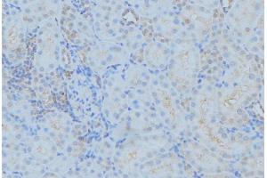 ABIN6279381 at 1/100 staining Mouse kidney tissue by IHC-P. (DYNC1H1 Antikörper  (Internal Region))