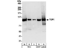 Western Blotting (WB) image for anti-Topoisomerase (DNA) I (TOP1) (AA 715-765) antibody (ABIN7450832) (Topoisomerase I Antikörper  (AA 715-765))