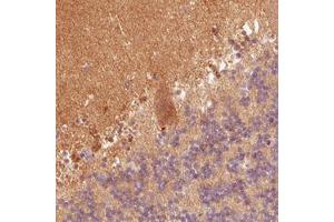 Immunohistochemical staining (Formalin-fixed paraffin-embedded sections) of human cerebellum with FABP7 monoclonal antibody, clone CL0236  shows positivity in the molecular cell layer and Purkinje cells. (FABP7 Antikörper)