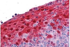 Human Tonsil: Formalin-Fixed, Paraffin-Embedded (FFPE) (S100A7 Antikörper  (AA 18-30))