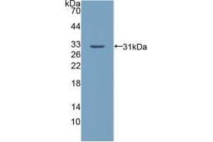 Western blot analysis of recombinant Human PALLD. (PALLD Antikörper  (AA 1137-1383))