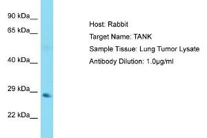 Host: Rabbit Target Name: TANK Sample Tissue: Human Lung Tumor Antibody Dilution: 1ug/ml (TANK Antikörper  (N-Term))