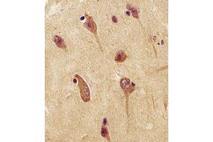 Antibody staining UCHL1 in human brain tissue sections by Immunohistochemistry (IHC-P - paraformaldehyde-fixed, paraffin-embedded sections). (UCHL1 Antikörper  (C-Term))