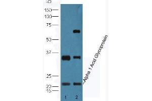 Lane 1: Human HepG2 cell lysates Lane 2: Mouse lung lysates probed with Anti-Alpha 1 Acid Glycoprotein Polyclonal Antibody, Unconjugated  at 1:5000 90min in 37˚C. (ORM1 Antikörper  (AA 101-201))