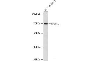 Western blot analysis of extracts of Mouse heart using GPAA1 Polyclonal Antibody at dilution of 1:3000. (GPAA1 Antikörper)