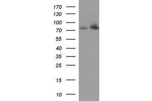 Western Blotting (WB) image for anti-Hydroxysteroid (17-Beta) Dehydrogenase 4 (HSD17B4) antibody (ABIN2715561)