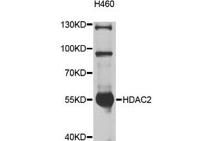 Western blot analysis of extracts of H460 cells, using HDAC2 antibody (ABIN5997878) at 1/1000 dilution. (HDAC2 Antikörper)