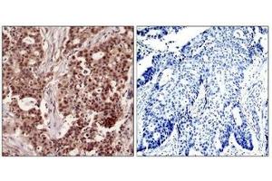 Immunohistochemistry (IHC) image for anti-Nuclear Factor of kappa Light Polypeptide Gene Enhancer in B-Cells 1 (NFKB1) (pSer927) antibody (ABIN7138732)