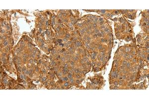 Immunohistochemistry (Paraffin-embedded Sections) (IHC (p)) image for anti-Collagen, Type IV, alpha 1 (COL4A1) antibody (ABIN7237920)