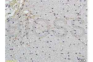 Formalin-fixed and paraffin embedded rat brain labeled with Anti-Claudin 5 Polyclonal Antibody, Unconjugated (ABIN673869) followed by conjugation to the secondary antibody and DAB staining (Claudin 5 Antikörper)