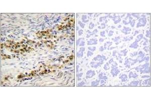 Immunohistochemistry analysis of paraffin-embedded human ovary, using Akt (Phospho-Ser246) Antibody. (AKT1 Antikörper  (pSer246))