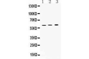 Western blot analysis of ATP4B expression in rat stomach extract ( Lane 1), mouse stomach extract ( Lane 2) and SGC7901 whole cell lysates ( Lane 3). (ATP4b Antikörper  (N-Term))