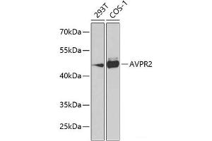 Western blot analysis of extracts of various cell lines using AVPR2 Polyclonal Antibody at dilution of 1:1000. (AVPR2 Antikörper)