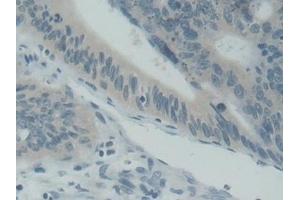 Immunohistochemistry (IHC) image for anti-Synaptosomal-Associated Protein, 25kDa (SNAP25) (AA 1-206) antibody (ABIN7443431)