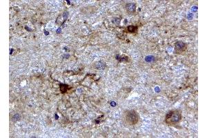 ABIN2562804 (2µg/ml) staining of paraffin embedded Human Cerebellum. (GFAP Antikörper  (C-Term))