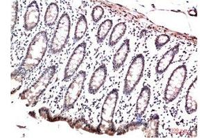 Immunohistochemical analysis of paraffin-embedded Human Colon Carcinoma Tissue using HP-1γ Mouse mAb diluted at 1:200 (CBX3 Antikörper)