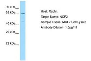 Image no. 1 for anti-Neutrophil Cytosolic Factor 2 (NCF2) (AA 429-478) antibody (ABIN6749984) (NCF2 Antikörper  (AA 429-478))