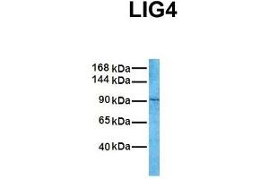 Western Blotting (WB) image for anti-Ligase IV, DNA, ATP-Dependent (LIG4) (N-Term) antibody (ABIN2778272)
