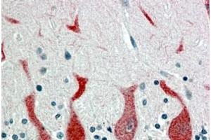 RARA polyclonal antibody  (4 ug/mL) staining of paraffin embedded human cerebellum. (Retinoic Acid Receptor alpha Antikörper)