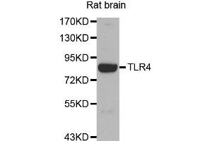 Western blot analysis of Rat brain tissue lysate using TLR4 antibody.
