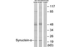 Western blot analysis of extracts from rat brain/mouse brain cells, using Synuclein-alpha (Ab-125) Antibody. (SNCA Antikörper  (AA 86-135))