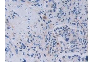 Immunohistochemistry (IHC) image for anti-Tumor Necrosis Factor (Ligand) Superfamily, Member 9 (TNFSF9) (AA 42-253) antibody (ABIN7441109)