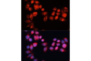 Immunofluorescence analysis of HeLa cells using  antibody (ABIN7265735) at dilution of 1:100 (40x lens). (ABCB7 Antikörper  (AA 503-753))