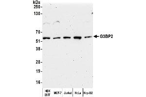 anti-GTPase Activating Protein (SH3 Domain) Binding Protein 2 (G3BP2) (AA 275-325) antibody