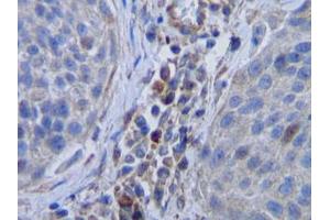 Image no. 1 for anti-Colony Stimulating Factor 1 (Macrophage) (CSF1) antibody (ABIN465551) (M-CSF/CSF1 Antikörper)