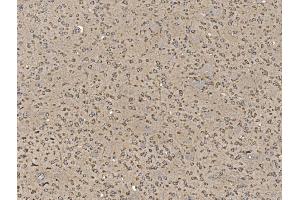 IHC analysis of EIF5 using anti-EIF5 antibody (ABIN7599722).