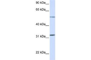 WB Suggested Anti-SLC35A5 Antibody Titration:  0. (SLC35A5 Antikörper  (N-Term))