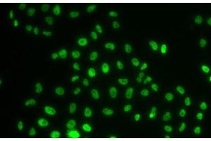 Immunofluorescence analysis of MCF-7 cells using PHIP Polyclonal Antibody (PHIP Antikörper)