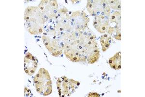 Immunohistochemistry of paraffin-embedded human stomach using NUMA1 antibody. (NUMA1 Antikörper)