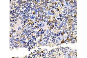 Immunohistochemistry of paraffin-embedded Rat spleen using UBE2V2 Polyclonal Antibody at dilution of 1:100 (40x lens). (UBE2V2 Antikörper)