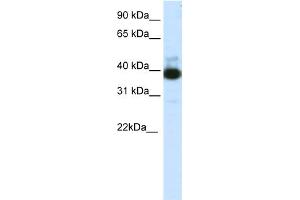 WB Suggested Anti-TTC19 Antibody Titration:  1.